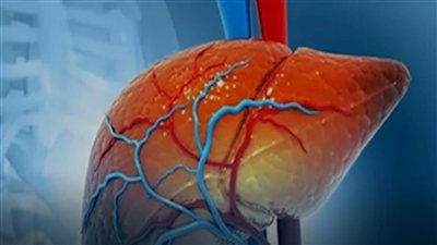 هناك علامة تظهر على اليدين والقدمين ليلًا قد تدل على الإصابة بمرض الكبد الدهني