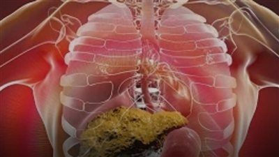 هناك علامة قد تظهر على اليدين والقدمين ليلًا وتستدعي الانتباه، فقد ترتبط بمرض الكبد الدهني.