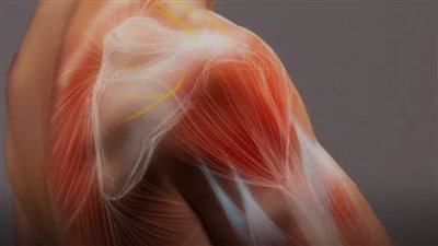 الساركوما.. أعراض تستدعي الانتباه والعلاج المبكر لتجنب المضاعفات