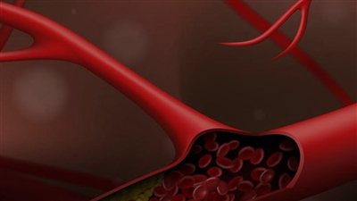 كيف تقلل الكوليسترول بدون دواء؟.. عادات مسائية تساعد على تحسين صحة القلب