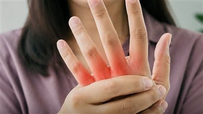 أعراض ارتفاع حمض اليوريك عند النساء.. علامات تحذيرية لا ينبغي تجاهلها