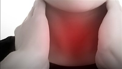 الغدة الدرقية لا تبدأ دائمًا بالإرهاق.. 4 علامات غير متوقعة لا تهملها
