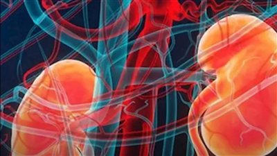 الكلى ترسل إشاراتها عند الاستيقاظ.. 4 علامات لا تظهر في البول انتبه إليها