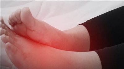 تورم القدمين بعد الاستيقاظ.. 5 أسباب صحية تستحق الانتباه لا تهمله