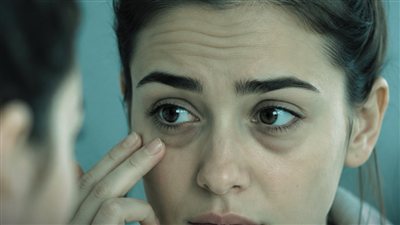 وداعًا لانتفاخ أسفل العين.. 7 طرق طبيعية لتخفيفه