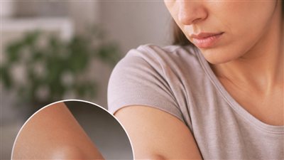 ظهور كتل صلبة تحت الجلد.. متى تكون طبيعية ومتى تستدعي القلق؟