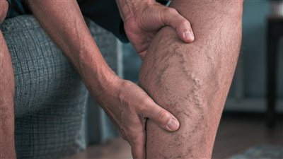 10 علامات تحذيرية تدل على انسداد الشرايين وتهدد صحتك
