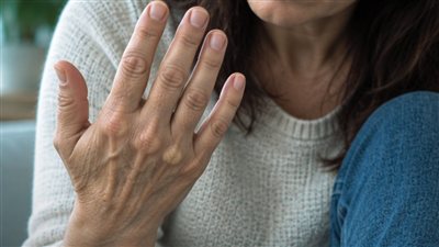 تظهر على اليدين والقدمين 5 علامات مبكرة لارتفاع الكوليسترول