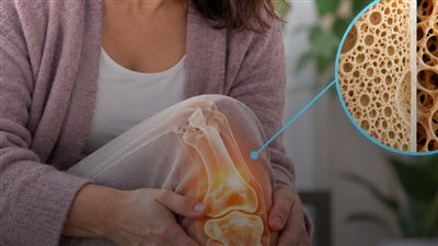هل بدأت عظامك تضعف؟ بعد عمر 45.. ما العلامات التي تكشف هشاشة العظام عند المرأة؟