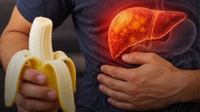 الموز والكبد الدهني.. ماذا يحدث للمريض عند تناوله؟